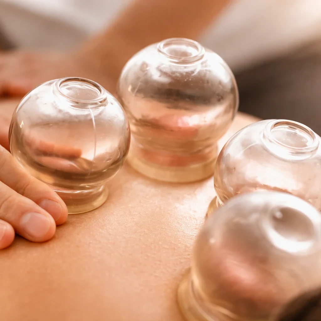 Cupping Massage
